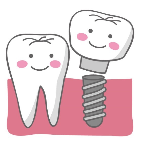 インプラントと歯周病の関係について